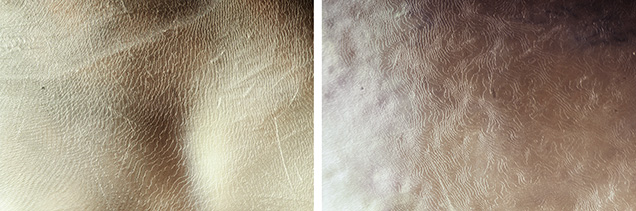 Platy structure typical of nacreous pearls