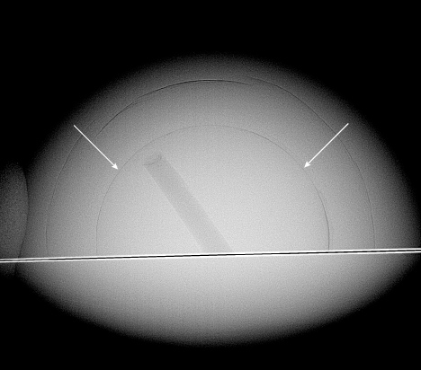 Figure 3. RTX image showing the half-pearl (top half) with a drilled bead indicated by arrows and shell backing (bottom half).
