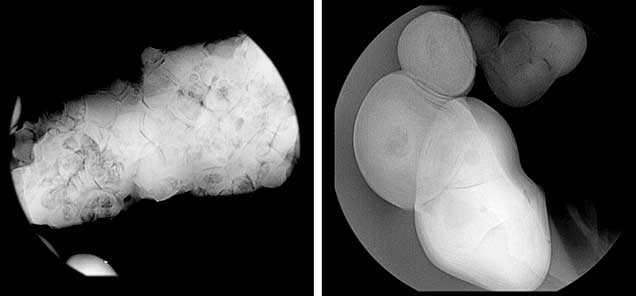 Blister pearl consisting of smaller seed pearls.