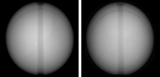 Microradiographs produced with an FPD (left) and an II (right)