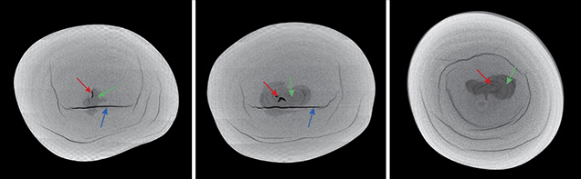 Three X-ray computed microtomography slices of a pearl