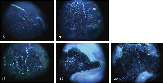 DiamondView Images of Pen Pearls