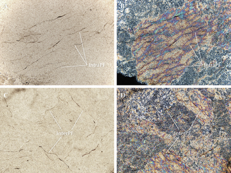 Four panels showing microscopic images with labeled features: "IntraPF" and "InterPF" in various textures and colors.