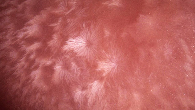 A 5.95 ct pink oval conch pearl exhibiting firework-like flame patterns. Photomicrograph by Hazel “Wing Kiu” Fan; field of view 5.98 mm.