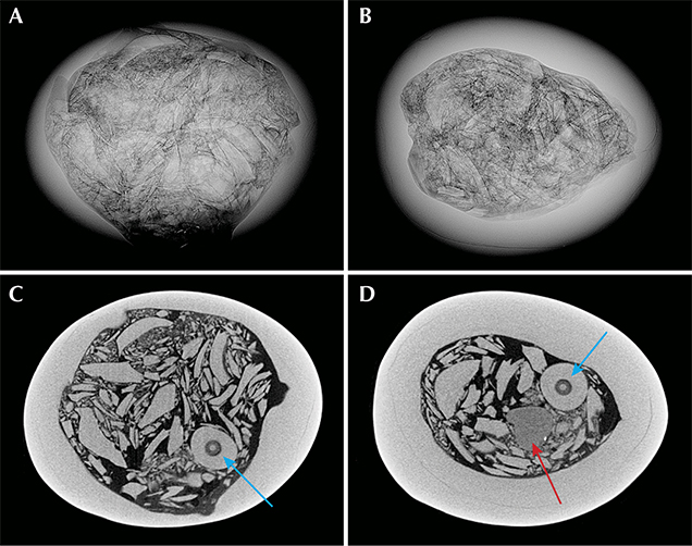RTX and μ-CT images of the internal structure of the pearl.