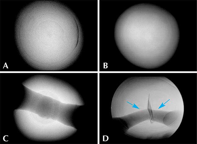 Internal growth structures of pearls studied by GIA.
