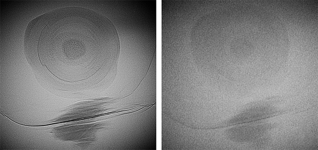Microradiographs produced with an FPD (left) and an II (right)