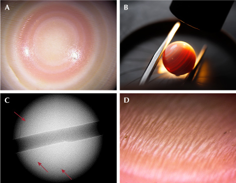 Figure 2. A: Concentric rings with alternating white, cream, and light pink color bands resembling a bull’s-eye; field of view 3 mm. B: Banded structure observed under fiber-optic illumination. C: Internal banding lines (red arrows) correlating to the external bands visible in image A. D: A pattern of parallel elongated slender flames imparting a silky sheen effect; field of view 1 mm. Photos by Gaurav Bera.