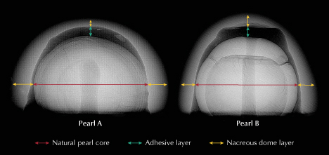 Figure 3. RTX imaging of both pearls revealing natural pearl cores (indicated by red arrows), void formations along with the radiolucent adhesive material (green arrows), and button-shaped nacreous domes (yellow arrows).