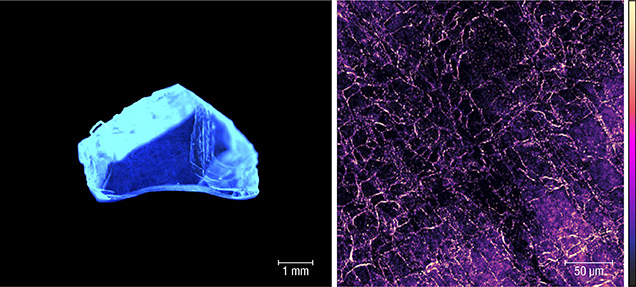 Imaging of dislocations in diamond