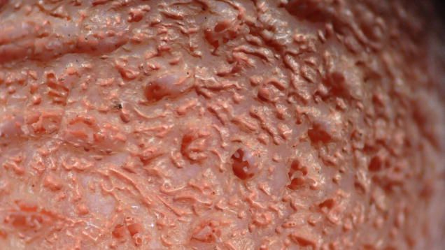 Close-up of textured skin, showing fine details and irregular patterns in a pinkish hue.