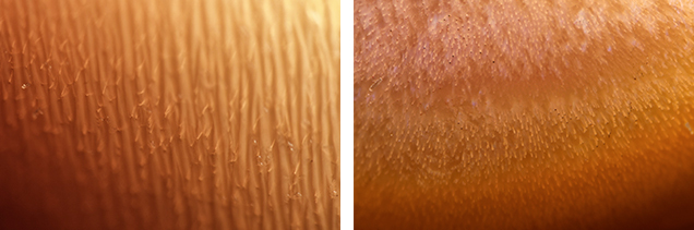 Acicular inclusions in a Spondylus shell and flame structure in a Spondylus pearl