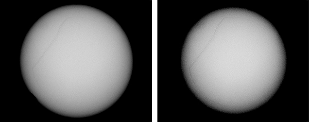 RTX images of a bead-cultured pearl