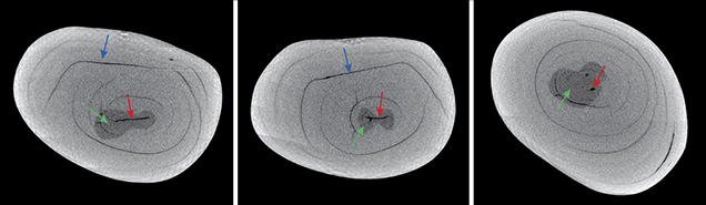 Three X-ray computed microtomography slices of a pearl