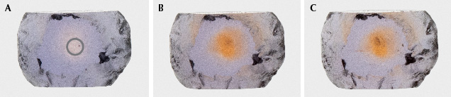 Figure 52. The Rock Creek sapphire in example 5, measuring 0.8 × 0.5 mm: unheated (A), heated to 1200°C in pure O<sub>2</sub> (B), and heated to 1700°C in pure O<sub>2</sub> (C). The gray circle shows area of analysis. Photos by Aaron Palke.