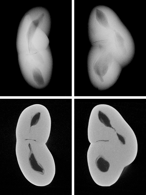 RTX and μ-CT images of non-bead-cultured pearl