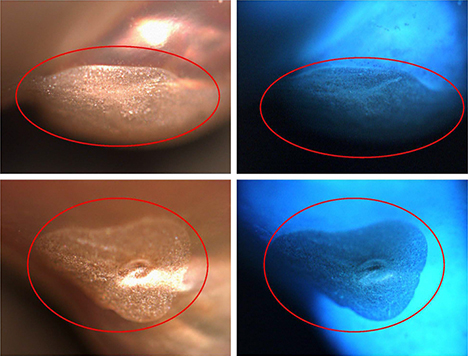 Filled portions of pearl in visible light (left) and DiamondView (right).