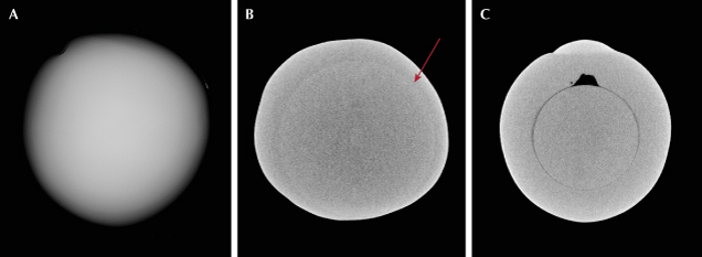 Figure 2. RTX (A) and μ-CT (B) imaging showing the subtle variation in radiopacity between the bead nucleus and the nacre (indicated by arrow). C. μ-CT scan of a bead cultured pearl for comparison showing the demarcation of the bead nucleus with a small organic gap.