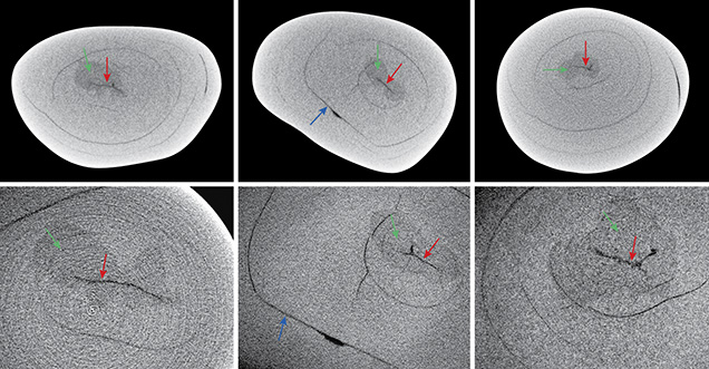 Three X-ray computed microtomography slices of a pearl