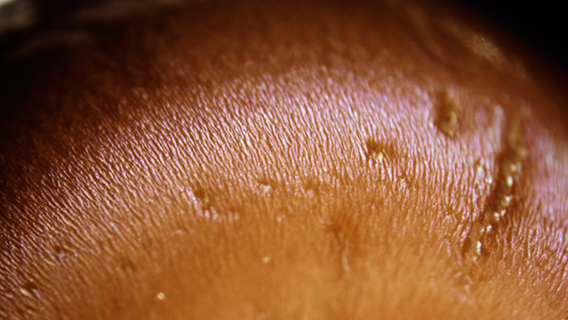 Bluish flame structures on non-nacreous pearl.