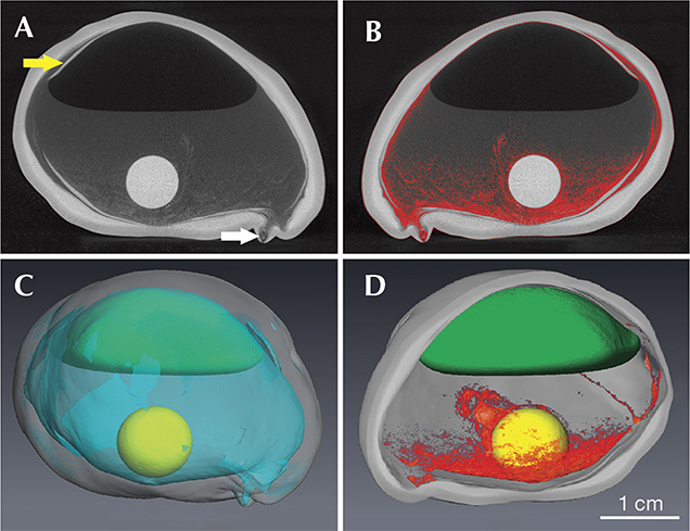 X-ray cultured pearl's origin