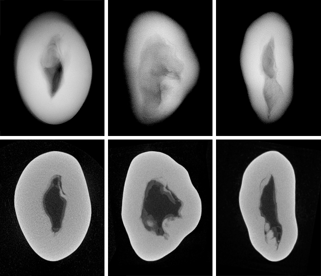 RTX and μ-CT images for a non-bead-cultured pearl