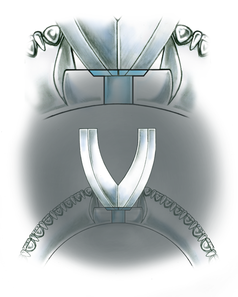 Illustration showing the side view of a platinum solitaire, with diamonds set in the shank