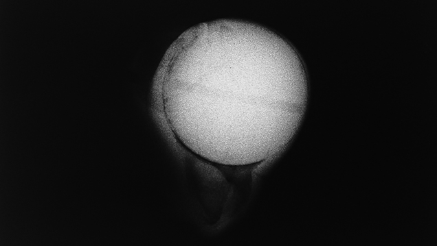 : X-radiography proved this was a bead-cultured pearl.