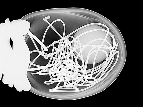 Figure 2. RTX image showing a hollow structure filled with a round bead nucleus and multiple metal wires.